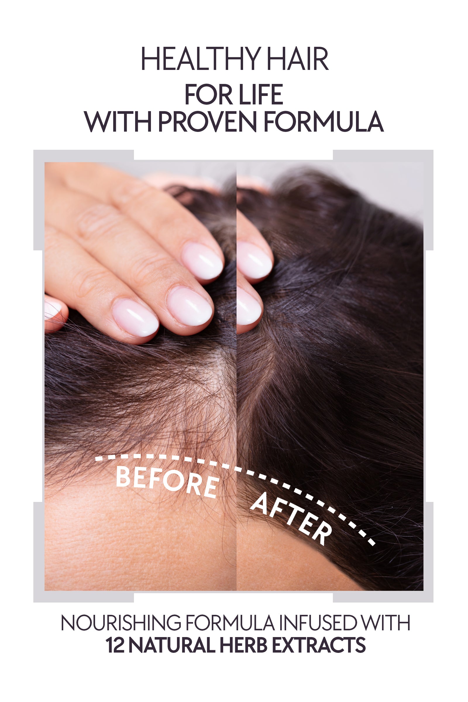 Biotin Shampoo to Help Reduce Hair Loss with 12 Herbal Extracts | SLS, Paraben, and Salt-Free |Scientifically Designed to Boost Growth and Health for Stronger, Thicker Hair by La Rachel Paris